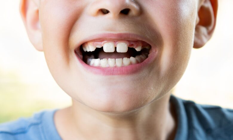 pediatric dentist aurora co